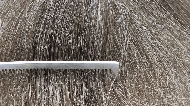 Badanie wykazało, że zmniejszenie stresu może czasami odwrócić trend siwych włosów